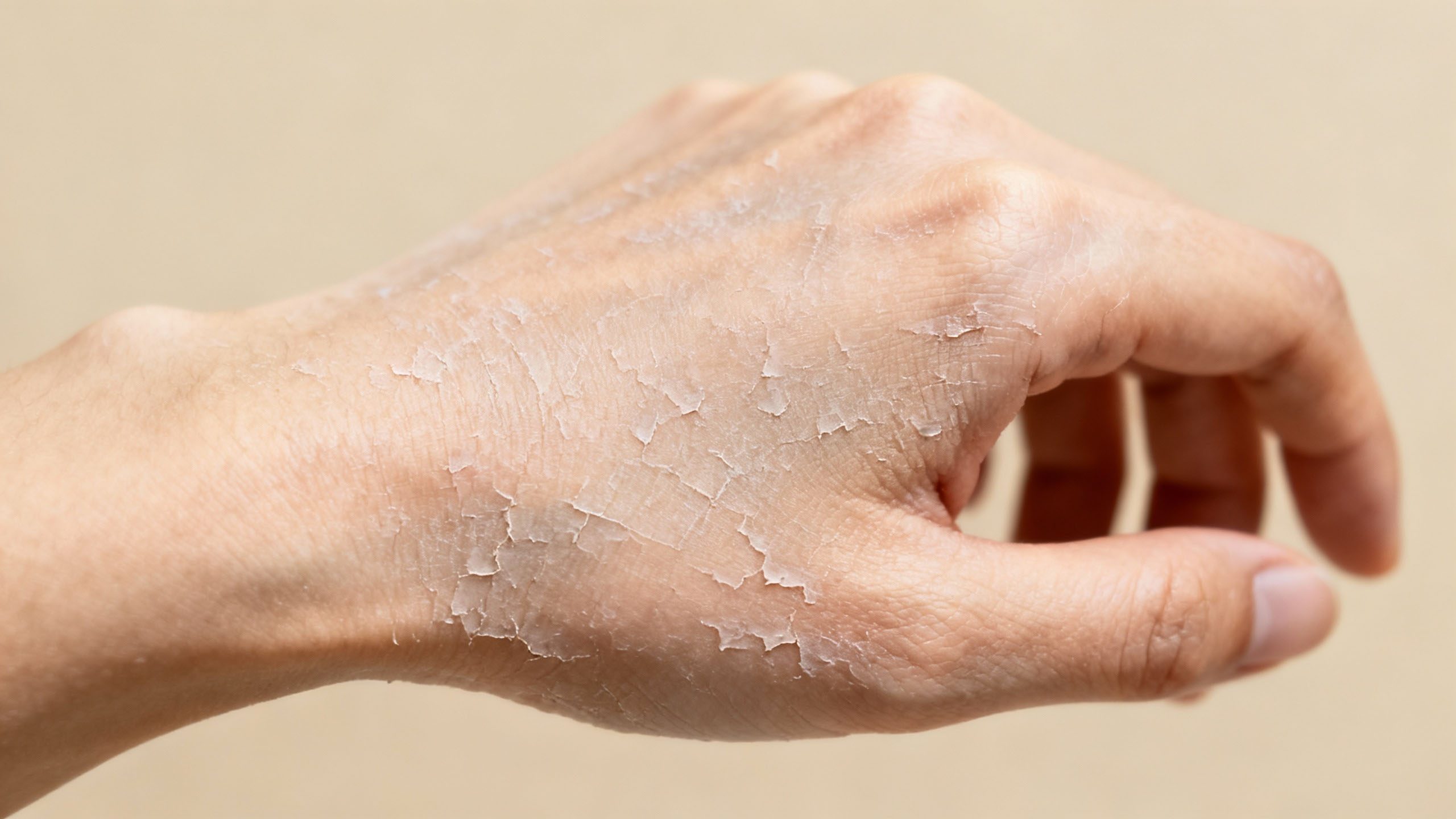 Skipping Moisturizer Skipping moisturizer and its effect on skin health